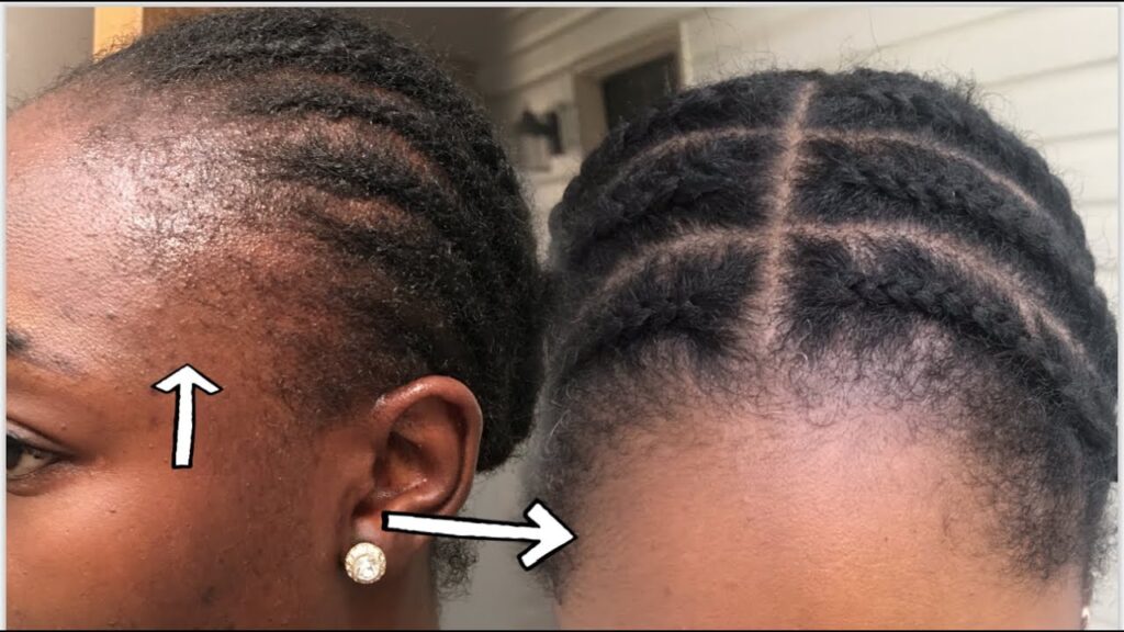Close-up braided cornrows with directional arrows